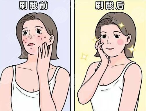 果酸換膚的副作用和危害多久會(huì)顯現(xiàn)出來(lái)?