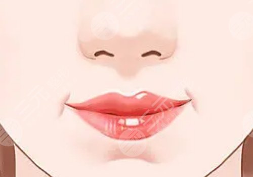 木偶紋和法令紋的區(qū)別