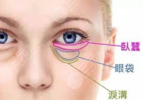 淚溝與眼袋的區(qū)別圖