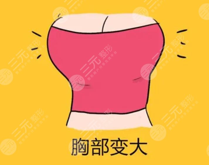 娜綺麗假體