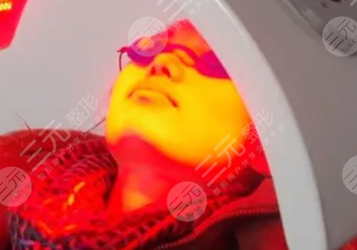 紅光緩解痤瘡能不能每天都照？