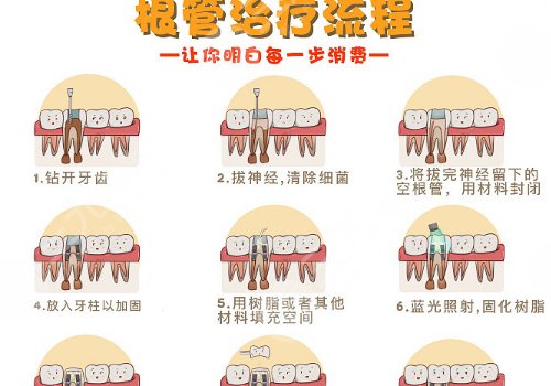根管緩解一顆全部費用