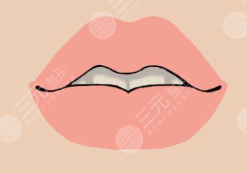 厚唇改薄能維持多久