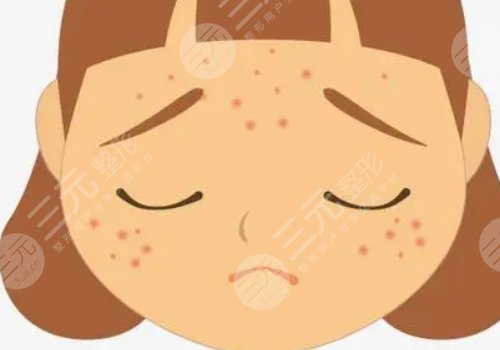 如何去除臉上的青春痘？