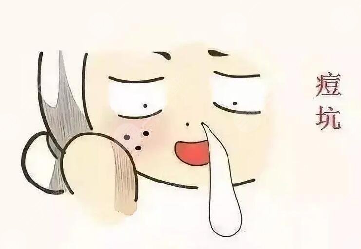 激光磨皮去痘印有效嗎？手術(shù)注意事項(xiàng)有哪些？哪些人適合做？
