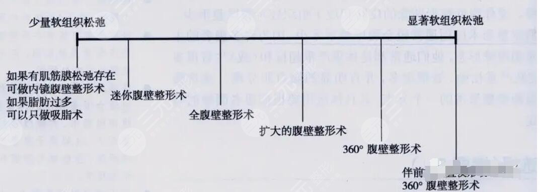 腹壁整形術多少錢?