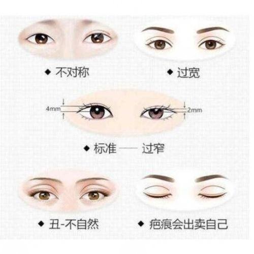 雙眼皮修復大概多少錢呢？
