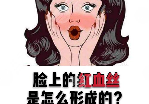 怎么減少紅血絲的產(chǎn)生？