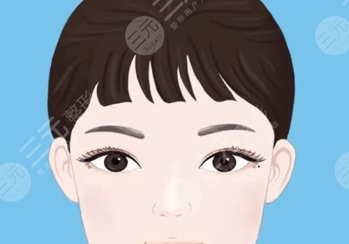 雙眼皮修復大概多少錢呢？