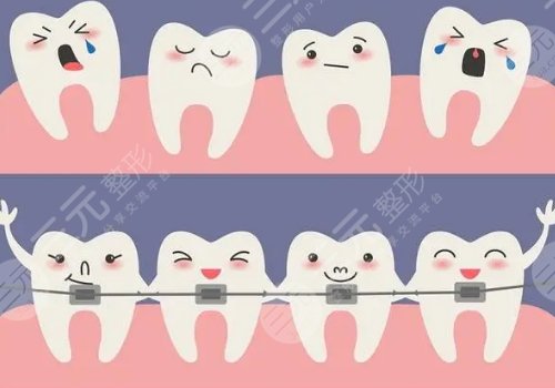 牙縫很大怎么辦?