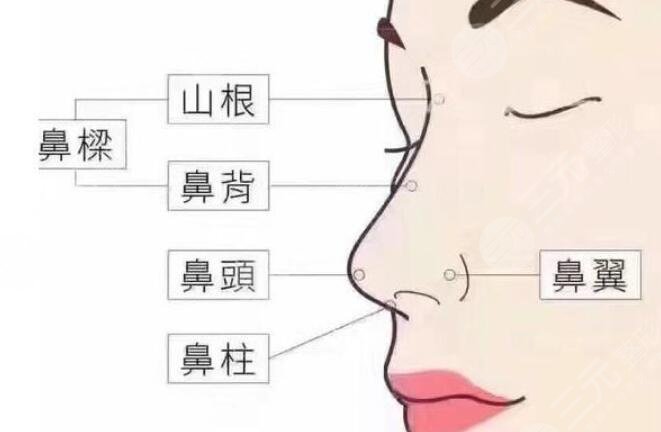 假體隆鼻后假體外露怎么辦？正確的處理方式可以減少鼻部傷害！