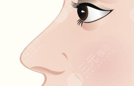假體隆鼻后假體外露怎么辦?