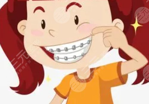 牙齒矯正用隱形牙套還是鋼絲牙套好？