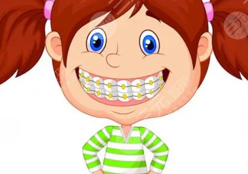 牙齒矯正用隱形牙套還是鋼絲牙套好？