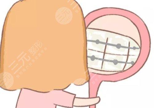 牙齒矯正用隱形牙套還是鋼絲牙套好？