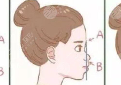 嘴凸是怎么造成的？