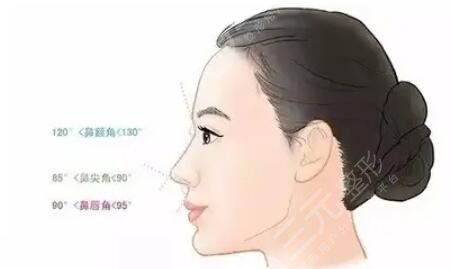 自體軟骨隆鼻好不好看？是從哪里取軟骨？優(yōu)缺點一文匯聚！