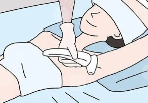 脫毛儀哪個(gè)牌子效果比較好？