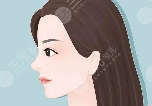 玻尿酸隆鼻子可以維持多久？