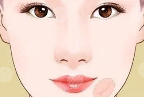 像素射頻儀器祛疤有用嗎？