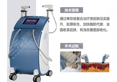 深藍射頻做一次有效果嗎？