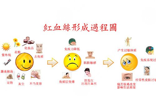 臉上長紅血絲怎么去掉？