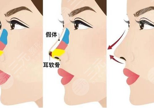 長(zhǎng)沙貝美醫(yī)療美容正規(guī)嗎?