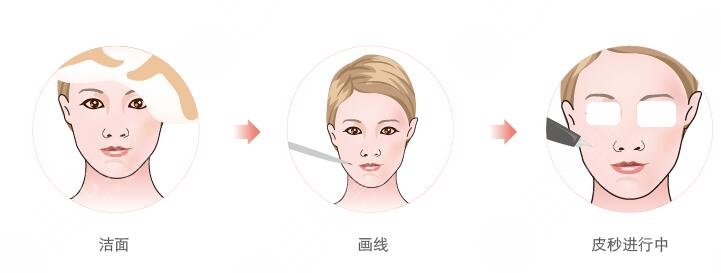 美白注射，水光注射管用嗎?