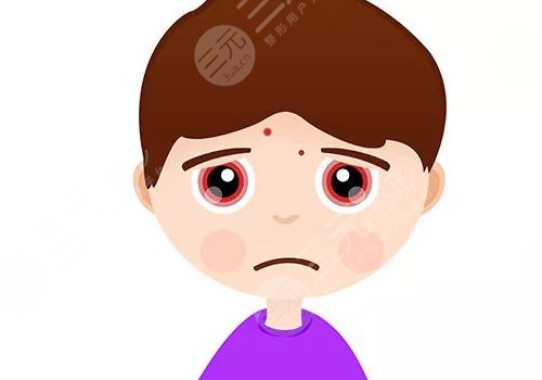 臉上有痘印怎么辦才能去掉呢？