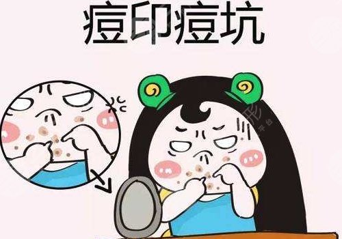 臉上有痘印怎么辦才能去掉呢？