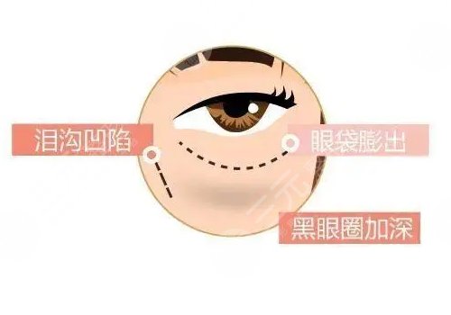 眼周抗衰綜合多少錢做一次？