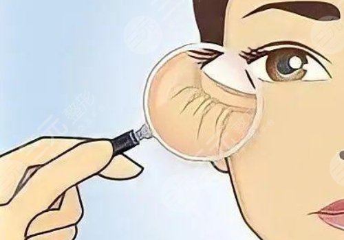 眼周抗衰綜合多少錢做一次？