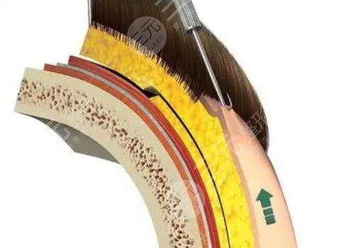 杜**醫(yī)生擅長項(xiàng)目