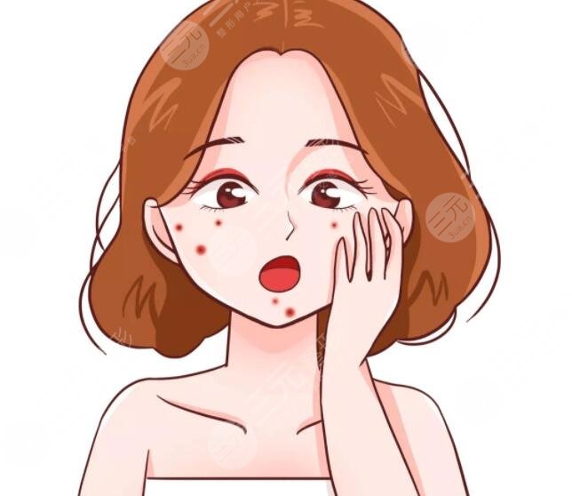 紅藍光緩解青春痘一次可以嗎?
