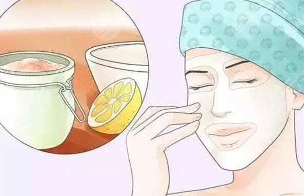 果酸換膚的價格貴不貴?