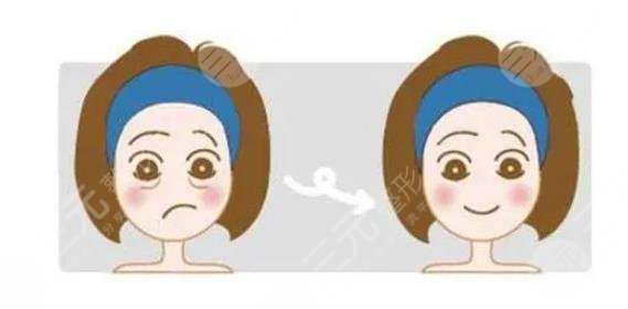 抽脂去眼袋會反彈嗎