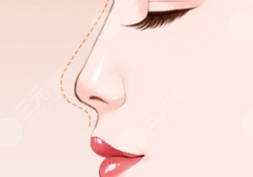 杜**做的鼻子好看嗎?