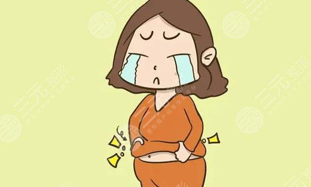 腹壁松弛整形