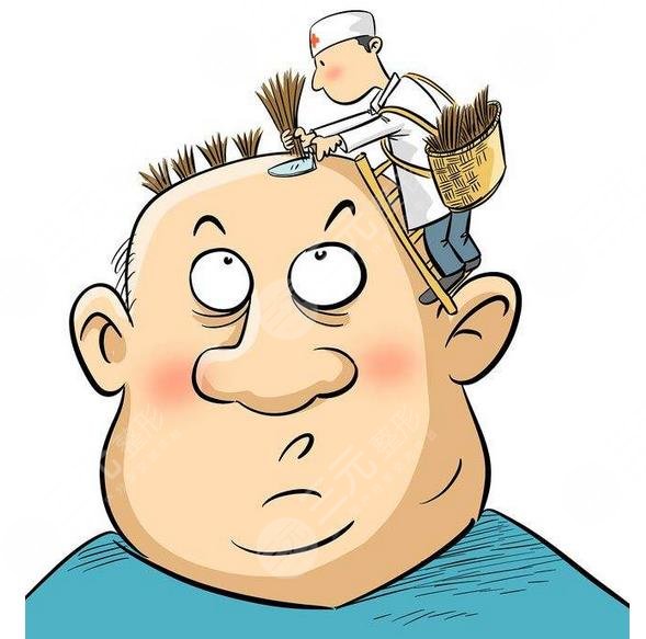 禿頂植發(fā)需要多少錢(qián)