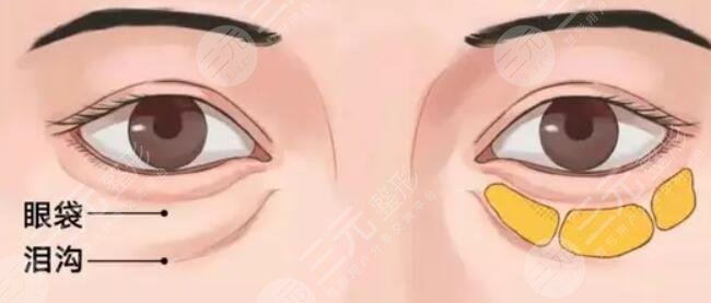 去淚溝