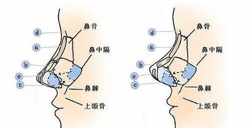 鄧正輝醫(yī)擅長項目: