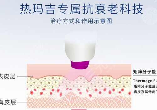 雙cwt熱瑪吉與普通熱瑪吉什么區(qū)別？