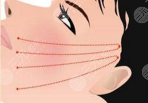 北京黃寺醫(yī)療美容診所做拉皮手術(shù)好嗎?