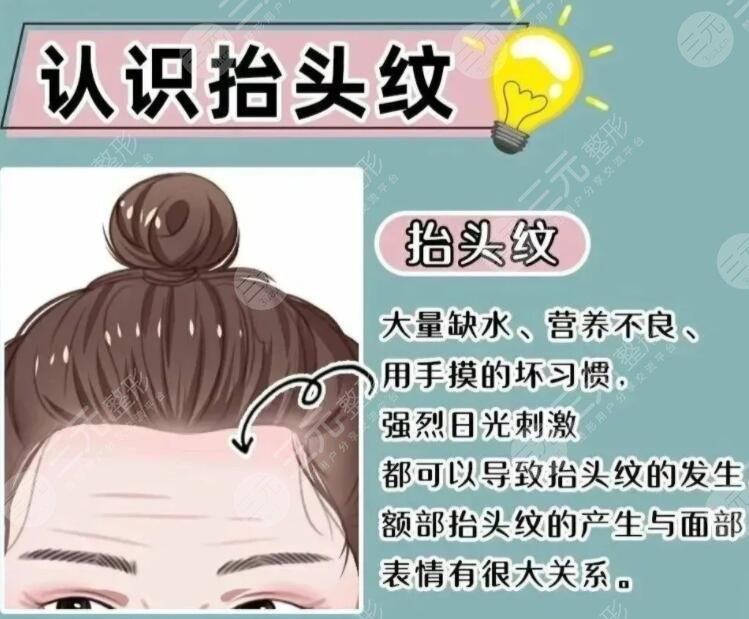 抬頭紋整形多少錢一般？哪些方法可以改良抬頭紋？