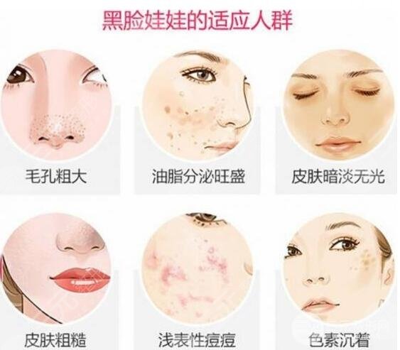 黑臉娃娃效果怎么樣好用嗎?