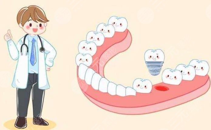 廣州穗華口腔醫(yī)院潔牙科普知識