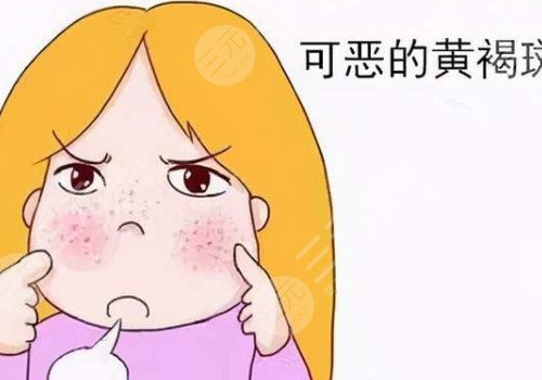 激光祛斑會不會反彈？