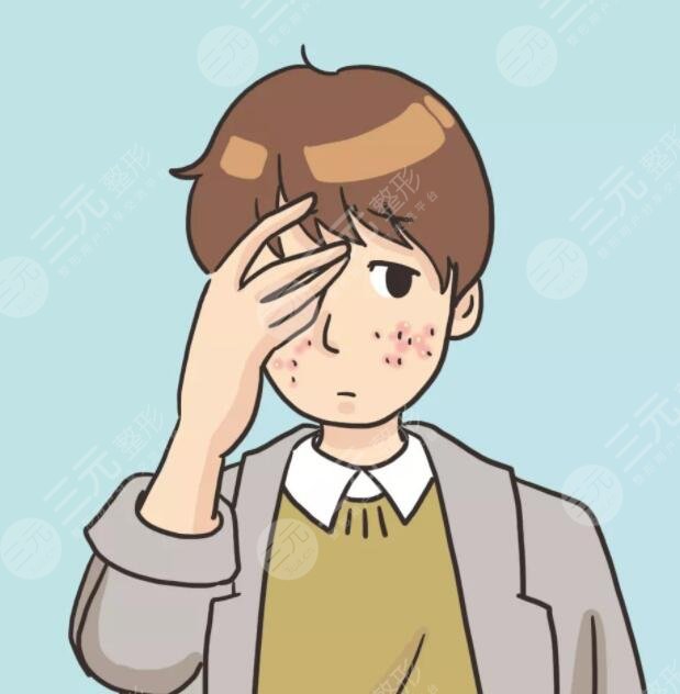 男生祛痘的小竅門是什么？做好這5點可以大大緩解痘??！