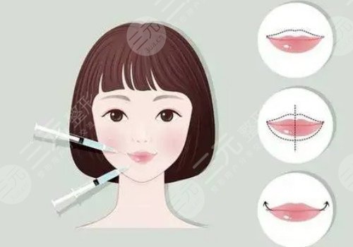 唇部注射玻尿酸需要注意什么？