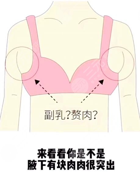6大腋下副乳運(yùn)動(dòng)消除方法！4分鐘消除副乳！甩掉拜拜肉！